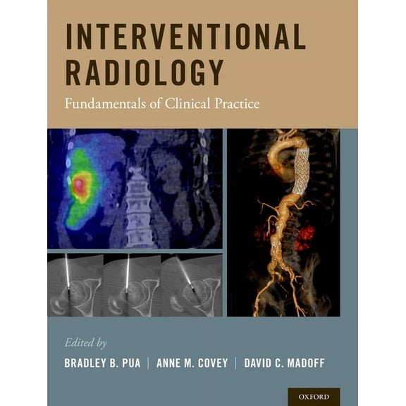 Interventional Radiology: Fundamentals of Clinical Practice, (Hardcover)