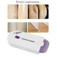 thumbnail image 2 of Finishing Touch Hair Remover Painless epilator with micro vibrations, 2 of 4