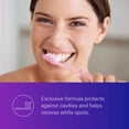 thumbnail image 5 of 3M - Crema dental anticaries Clinpro Tooth Creme 0.21% NAF de ESPE 12117, vainilla y menta (paquete de 1) 3M NA, 5 of 5