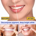 thumbnail image 3 of Tiras Blanqueadoras De Dientes 5D Whitestrips Supreme Bright, 14 Tratamientos Muyoka Hogar, 3 of 6