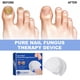 thumbnail image 5 of Nail Care Device Repairs Rotten Nails, Ingrown Toenails, Thickens Nails, Brightens Nails, Gently Cleans Onychomycosis, And Cares For Onychomycosis, 5 of 5