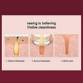 thumbnail image 5 of Professional Blackhead Vacuum Cleaner, Blackhead Extractor, USB Rechargeable Vacuum Skin Device with LED Display, 3 Modes(Rose gold), 5 of 5