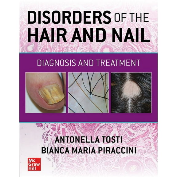 Disorders of the Hair and Nail: Diagnosis and Treatment, (Hardcover)