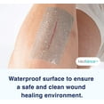 thumbnail image 5 of MedVance Silicone Tape 2" Wide Soft with Perforation and Cuttable (1 Pack, 1.5 Yards), 5 of 6