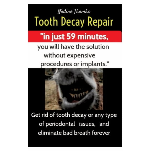 Tooth Decay Repair, dental care, swollen gums, bad breath, dental plaque, dental caries, gum disease, teeth whitening, d, (Hardcover)
