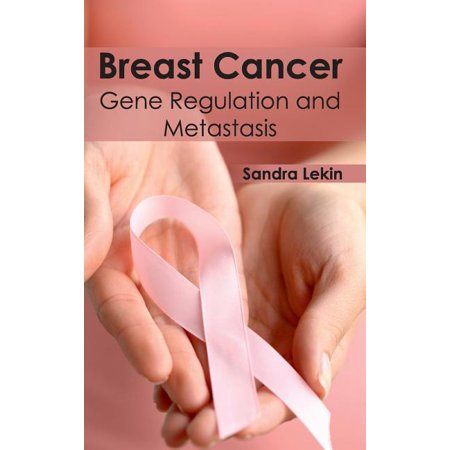 ISBN 9781632410665 product image for Breast Cancer: Gene Regulation and Metastasis (Hardcover) | upcitemdb.com