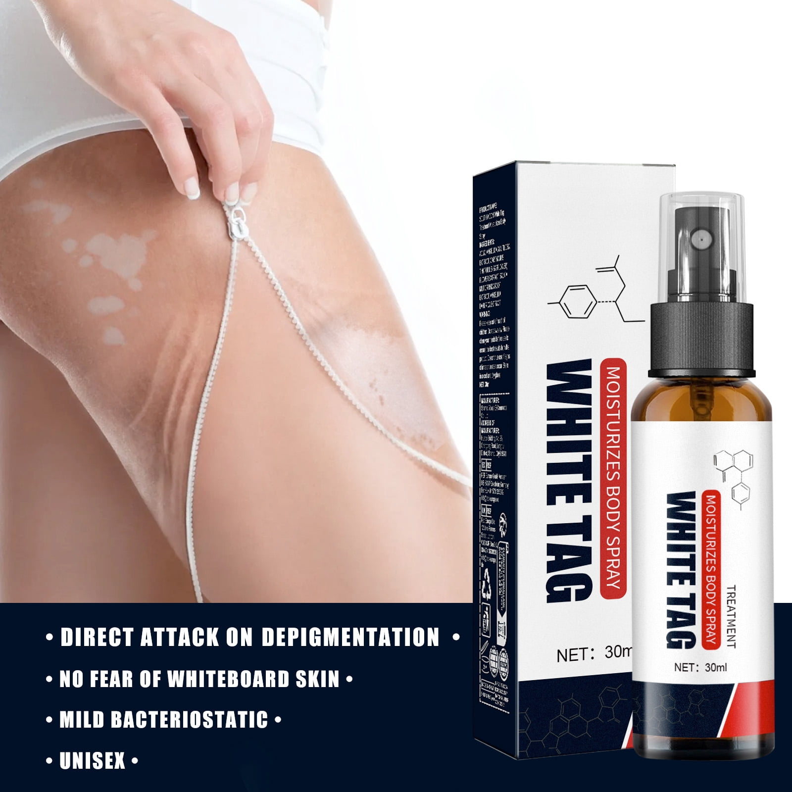 Alvantor Skin Repair Spray Moisturizing Body Treatment for Uneven Skin Tone, 1.01fl.oz