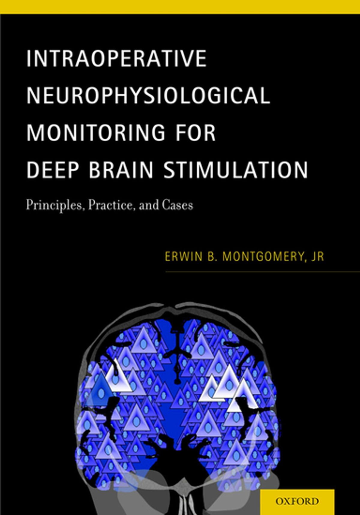 Intraoperative Neurophysiological Monitoring for Deep Brain Stimulation ...