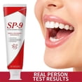 thumbnail image 2 of Wmool Sp 9 Dentifrice, Sp!9 Ultra Blanchissant!Sp 9 Dentifrice Probiotique, 2 of 8