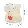 thumbnail image 4 of Modelo de enseñanza de estudio de dientes modelo de dientes modelos de dientes dentales modelo de enfermedad periodontal para enseñanza de laboratorio ANGGREK Otros, 4 of 8