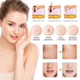 thumbnail image 3 of Pluma de Plasma, 15 Niveles, Dispositivo de Cuidado Facial con Tecnolog&iacute;a de Plasma, USB Recargable, Pantalla LED, Compacto para Uso Personal y Profesional (Blanco Perla), 3 of 8