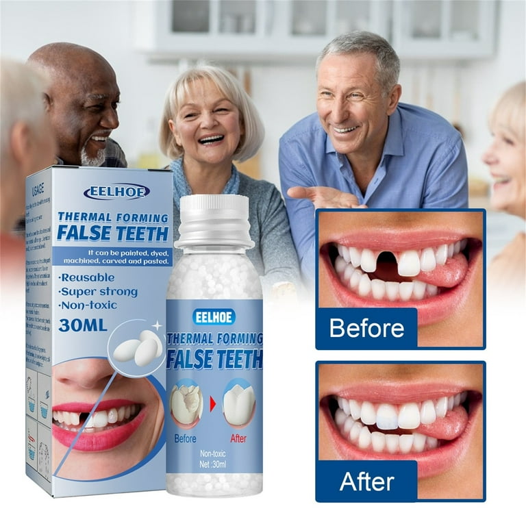 Tooth Repair Kit Gaps Filling Tool Teeth Temp Tooth Fake Teeth Denture Glue  for Dental Cement Temporary Tooth Fangs with Glue Teeth Gaps False Teeth  Solid Glue Denture Adhesive Repair Kit 