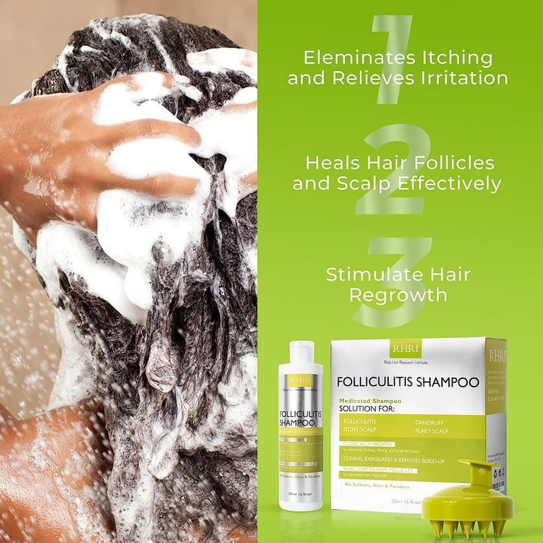 Shampoo for 2024 scalp folliculitis