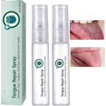 thumbnail image 1 of 1-3X Tongue Repair Spray 30ml Reduce Swelling Tongue Relief Treatment Spray for Bad Breath, Tongue Repair Spray for Dryness& Bad Breath, 1 of 5