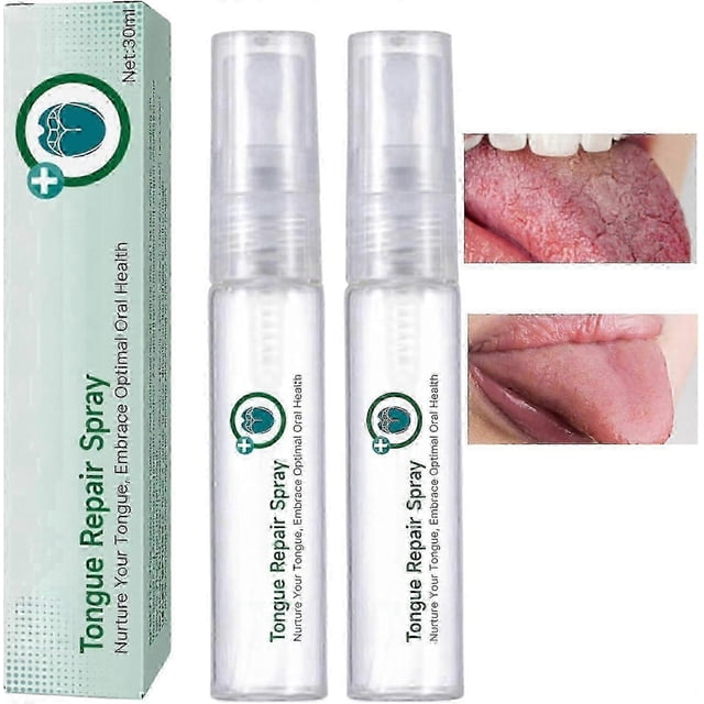 1-3X Tongue Repair Spray 30ml Reduce Swelling Tongue Relief Treatment Spray for Bad Breath, Tongue Repair Spray for Dryness& Bad Breath