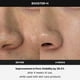 thumbnail image 5 of Dispositivo de tratamiento facial Medicube Age-R Booster-H, 5 of 7