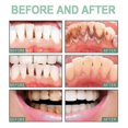 thumbnail image 3 of EELHOE floss teeth oral cleaning teeth pick disposable household portable denta, 3 of 4