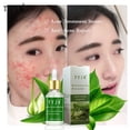 thumbnail image 3 of Clearance!Maojin Aceite de aloe Extracto antiarrugas Marcas de eliminación de acné, 3 of 9