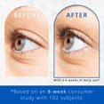 thumbnail image 4 of Sérum realzador de cejas SKIN RESEARCH NeuLash 3.2 ml, 4 of 7