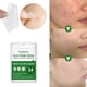 thumbnail image 1 of Pegatinas de parche para el acnéremovedor de espinillas invisible hidrocoloidecuidado de la piel (24 uds) Ehuebsd cuidado belleza, 1 of 7