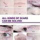 thumbnail image 4 of 4 hojas de silicona para cicatrices, tiras de gel, parche adhesivo para eliminar cicatrices (75 mm) Ygjytge Cuidado Belleza, 4 of 9