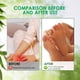 thumbnail image 4 of Foot Finish Foot Repair Cream For Athletes Foot-Treatment - 4oz Foot Cream For Dry Cracked Feet - TeaTree Toenail -Treatment ，Athlete's Foot Repair Cream, 4 of 9