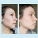 thumbnail image 4 of Gel Peel Perfect Image Ácido glicólico 50% con retinol 30 ml, 4 of 9