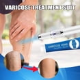 thumbnail image 2 of Set de terapia de luz azul para venas varicosas, crema para venas varicosas y bolígrafo de terapia de luz azul, 2 of 5