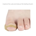thumbnail image 2 of Corrector Profesional De Uñas Encarnadas Para Pies, Pegatinas Para El Cuidado De Las Uñas De Los Pies, Herramientas De Pedicura Para El Cuidado De La Salud 40 Uds Speravity CE008976-01, 2 of 6