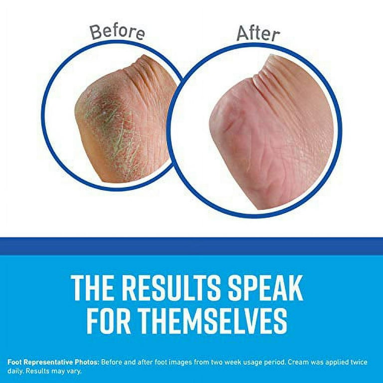 Feet are store extremely dry