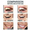 thumbnail image 4 of New Teeth Whitening Essences Extra Strong White Hygiene Tooth Whitener Stain Removal Oral Hygiene Whitening Gel Remove Plaque And Stains Cleaning Tw, 4 of 5