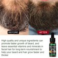 thumbnail image 4 of Fiudx Liquidación de ofertas flash El aceite para el crecimiento de la barba los hombres 30 ml suaviza la barba de rápido crecimiento y el cuidado los hombres de la barba, 4 of 7