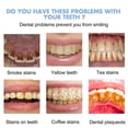thumbnail image 2 of Gel probiótico de regeneración dental, para todo tipo de problemas bucales, especialmente la regeneración dental, 2 of 5