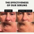 thumbnail image 3 of Sérums faciales Eclat Skincare, paquete de 3 unidades de vitamina C y ácido hialurónico, 3 of 6