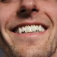 thumbnail image 4 of LOVEVER 4 Pcs Gold-plated Hat Grill Single Tooth Accessories Denture, 4 of 8