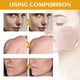thumbnail image 5 of Limpiador facial para el cuidado de la piel Blanqueador de piel para axilas, Blanqueador de piel para rostro y cuerpo, Blanqueador para axilas, cuello, rodillas, codos 120 ml (Compre 2 y ahorre 10 %), 5 of 9