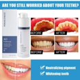 thumbnail image 4 of Extracto de limpieza dental, Yanshi gel para el cuidado dental 30ml suaviza la sensibilidad oral unisex Yanshi Extracto de limpieza dental, 4 of 6