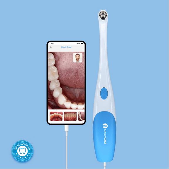 USB Personal Dental Intraoral Camera
