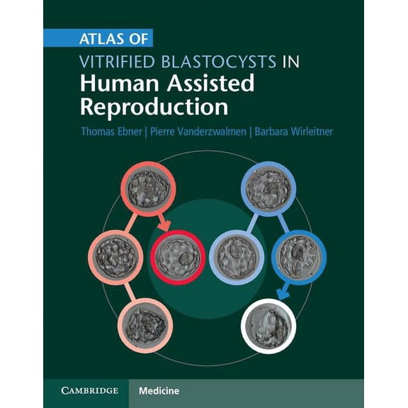 Atlas of Vitrified Blastocysts in Human Assisted Reproduction, (Hardcover)