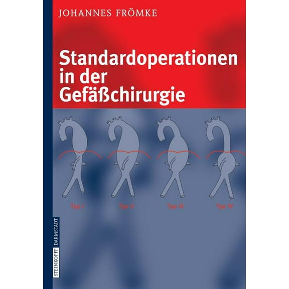 Standardoperationen in Der GefäÃchirurgie, (Hardcover)
