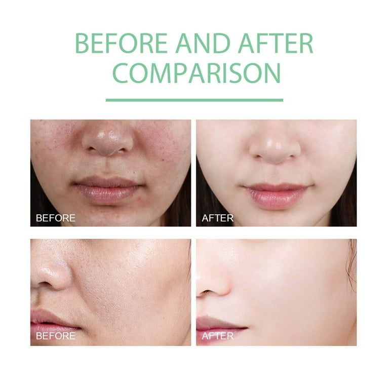 JIASONJY Herbal Exfoliating Gel Mildly Cleans Closed Mouth JIASONJY Herbal Exfoliating Gel Mildly Cleans Closed Mouth