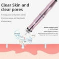 Portable Small Blackhead Removal Water Spray Bubble Cleansing Machine