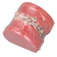 thumbnail image 3 of Modelo Dental de Ortodoncia ANGGREK Resina Desmontado, 3 of 7