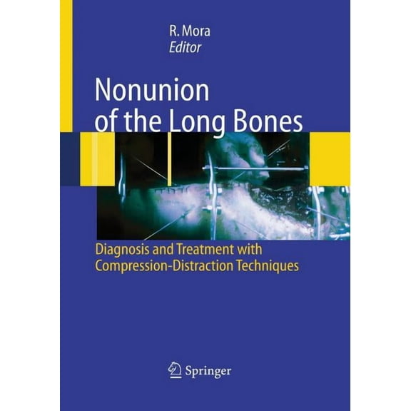 Nonunion of the Long Bones: Diagnosis and Treatment with Compression-Distraction Techniques, (Paperback)