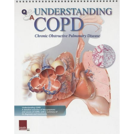 UPC: 9781932922295 | Understanding COPD Flip Chart (Other)