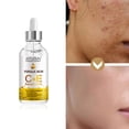 thumbnail image 1 of Fiudx Suero Ferúlico, Hidratante Facial Radiante And Brillo Radiante, Esencia Antiedad de Nanopartículas, Fórmula Antioxidante Natural, Protección de La Piel de Uso Diario, Apto para Todo Tipo de Pie, 1 of 7