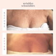 thumbnail image 6 of Wrinkles Schminkles - InfuseFAST Decolletage Sheet Mask - 5 Pack, 6 of 6