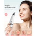 thumbnail image 3 of Acne Remover For Women And Men, Pore Vacuum With Exfoliating Machine Function, Includes 5 Suction Probes And 3 Adjustable Suction Levels, Ideal For, 3 of 5