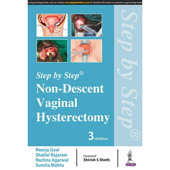 Step by Step: Non-Descent Vaginal Hysterectomy (Paperback) by Neerja Goel, Shalini Rajaram, Rachna Agarwal