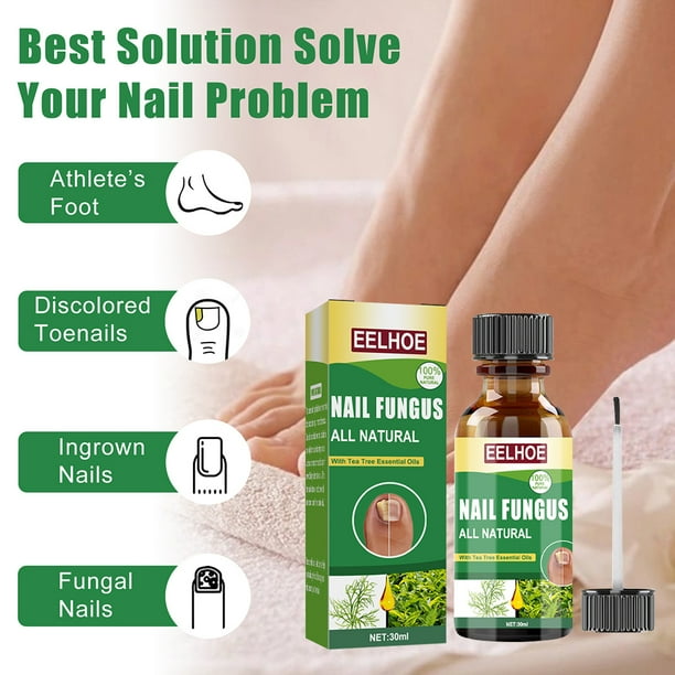 Solución de hongos en las uñas Aceite de árbol de té Reparación de uñas Reparación de esencia Líquido Cuidado de las uñas de los pies